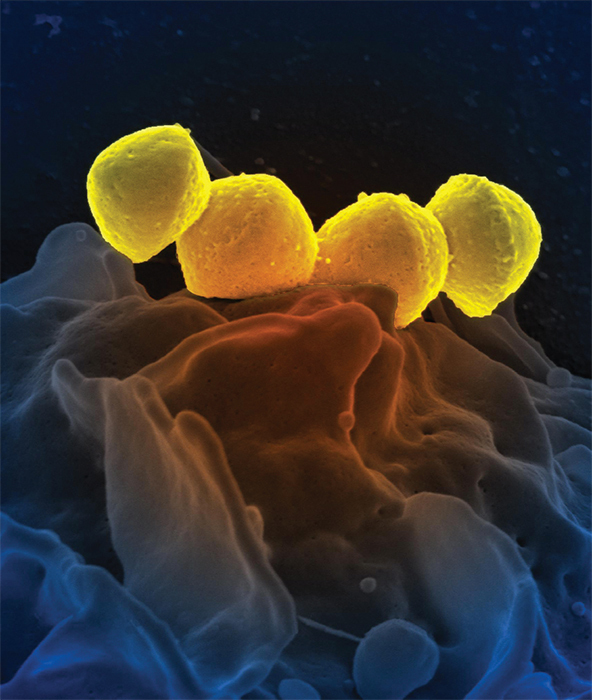 A scanning electron micrograph image of Streptococcus bacteria. Niaid/Flickr
