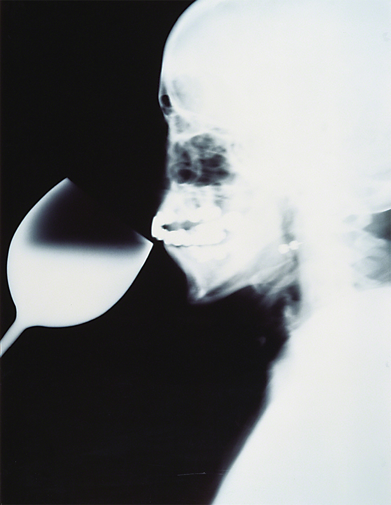 Isa Genzken, X-Ray, 1991, gelatin silver print, 39 3/8 × 31 1/2".